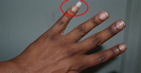 Long Pinky Fingernails On Men